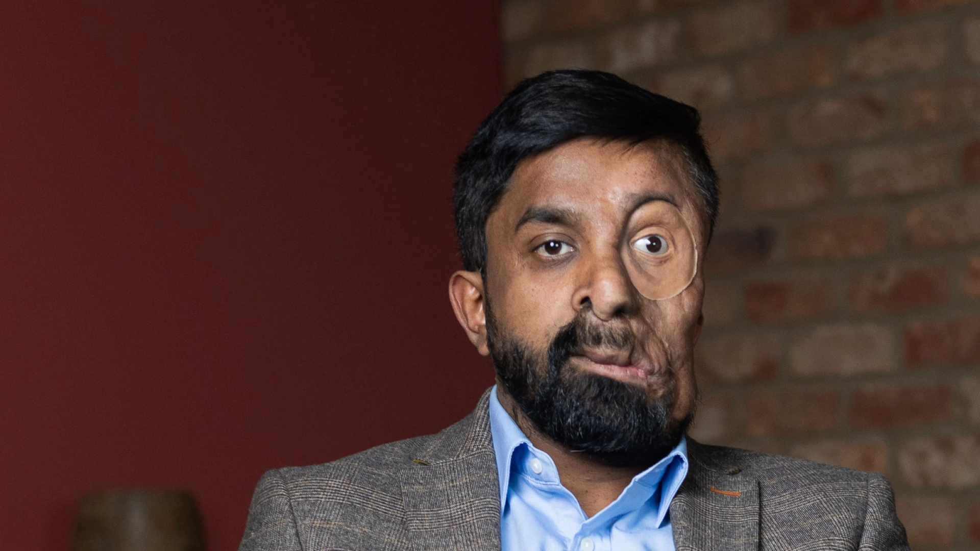 «Se negaron a atenderme en un café por mi cara», denuncia Amit Ghose.