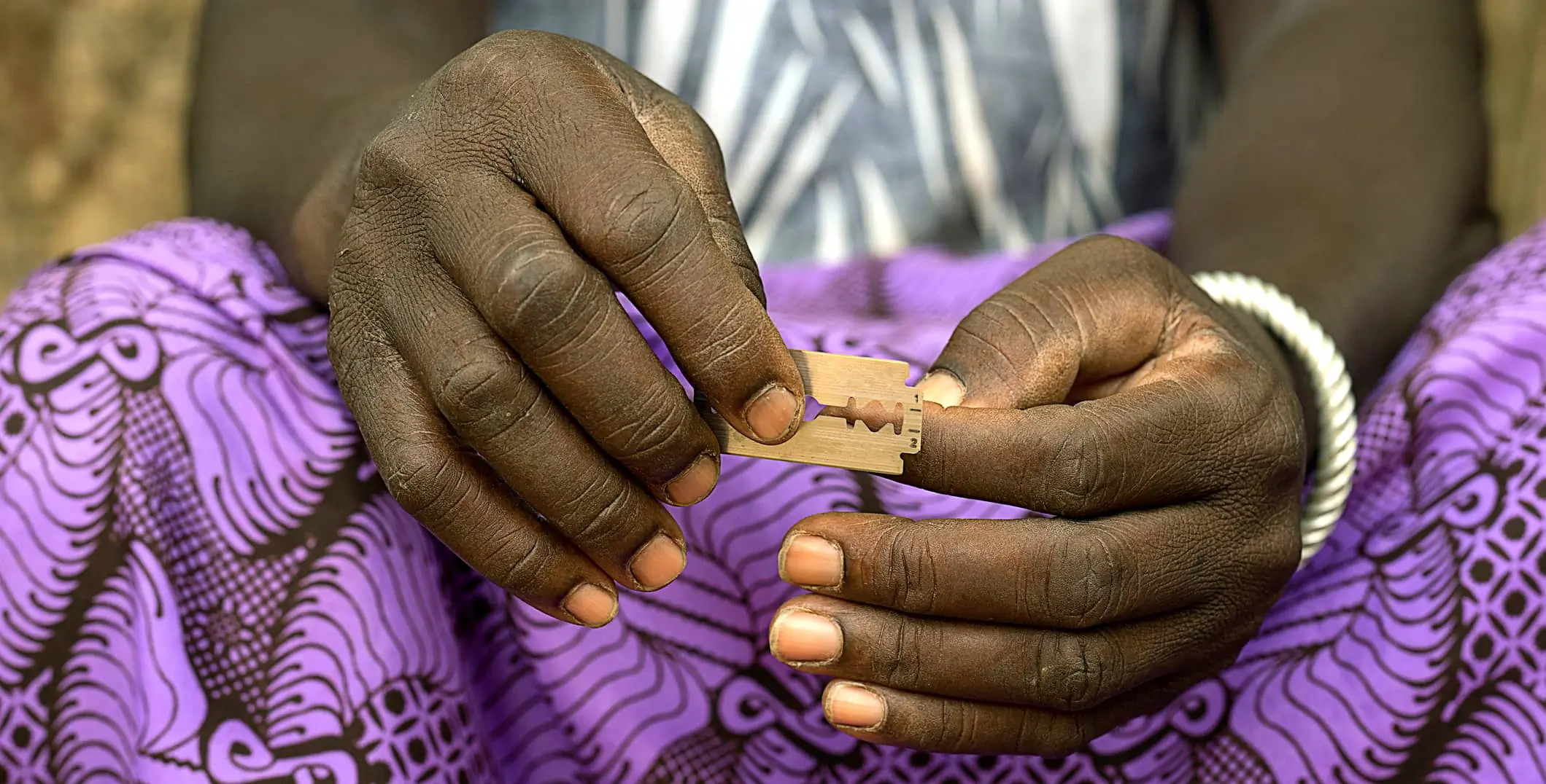España registra casos de mutilación genital femenina en niñas: un desafío persistente.