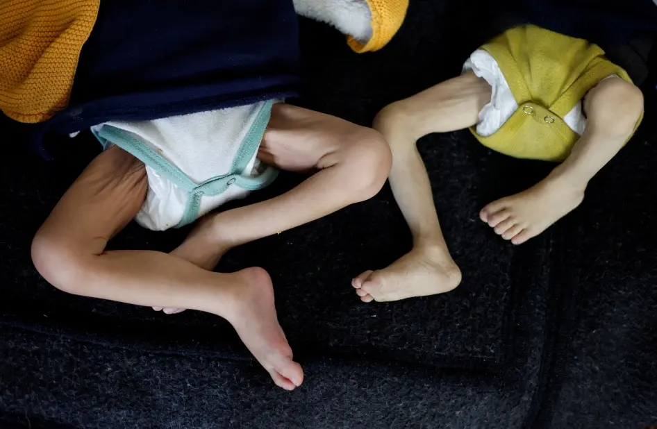 Tragedia en Gaza: 88 Niños Mueren por el Hambre en Medio del Conflicto.